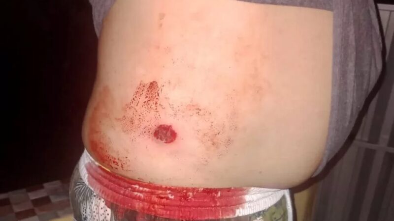 Conflito em área rural de Porto Seguro deixa produtor ferido e reacende disputa por terras