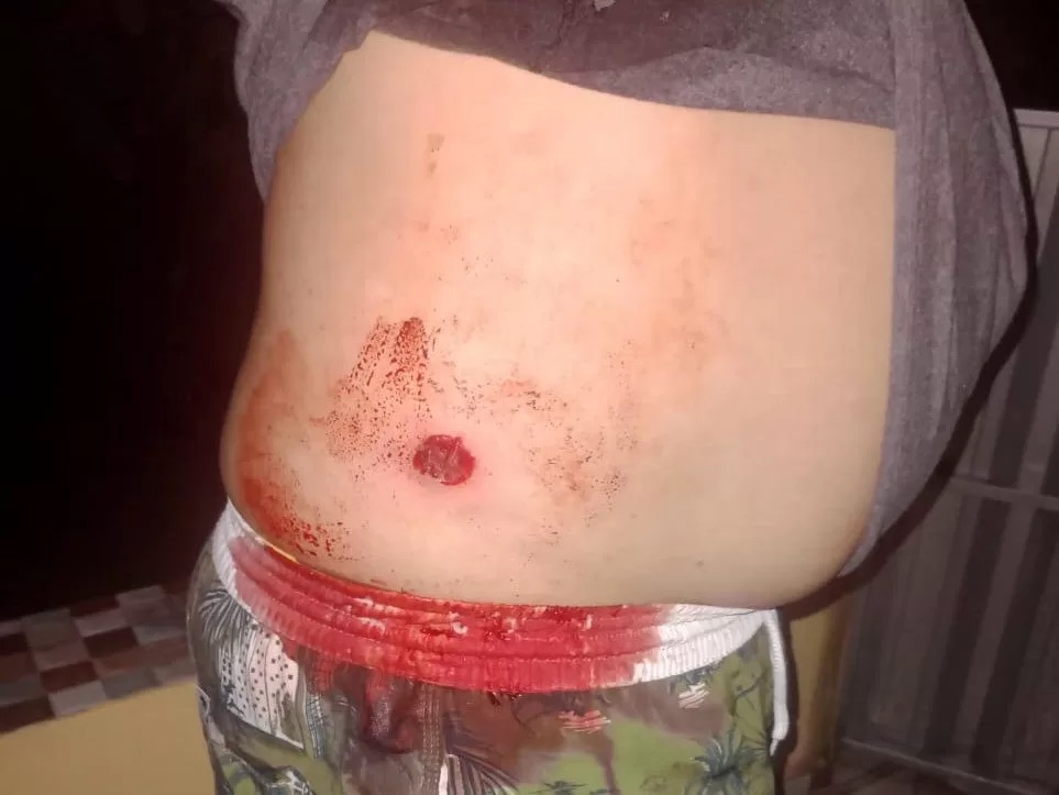 Conflito em área rural de Porto Seguro deixa produtor ferido e reacende disputa por terras